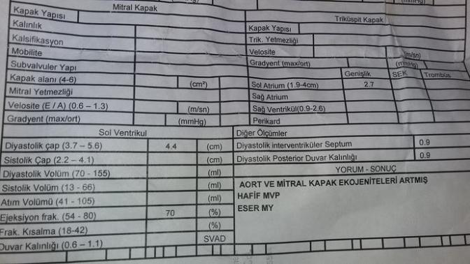 Kalp damar doktoru var mi aramizda? acil? Resimli?