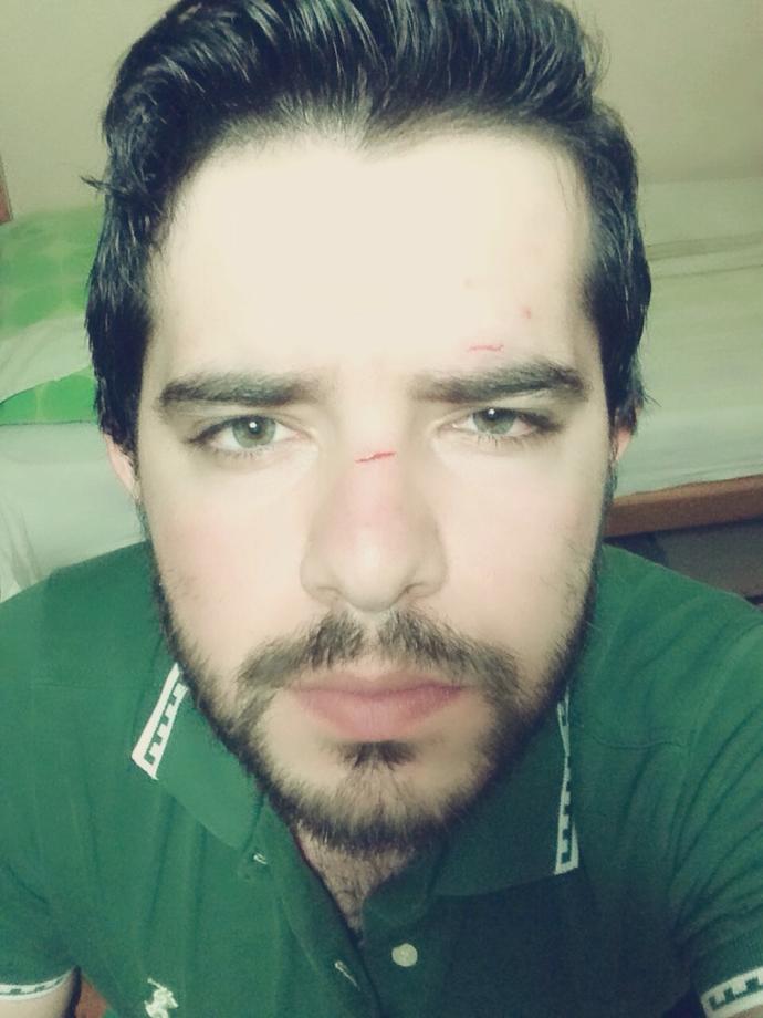 Kavgada yuzume darbe aldim bu iz icin krem?