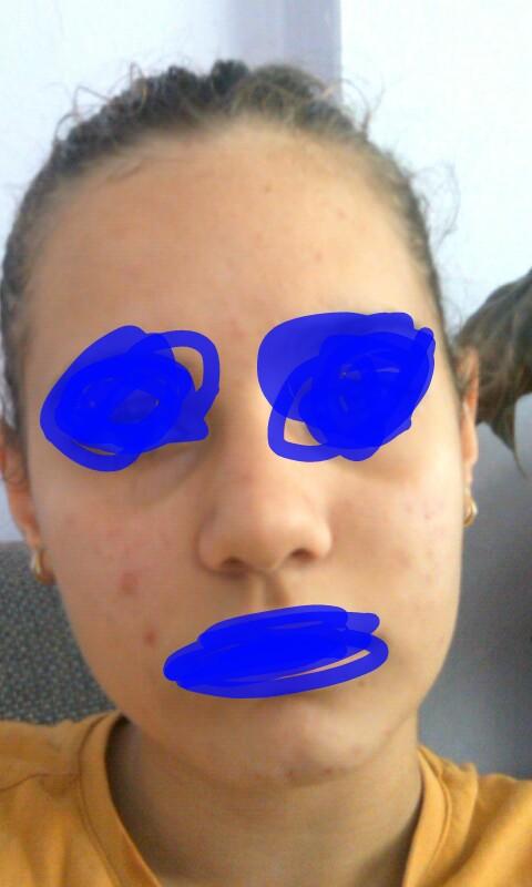 Cildim cok cirkin?