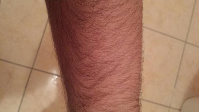 Kollarım çok mu kıllı sizce??