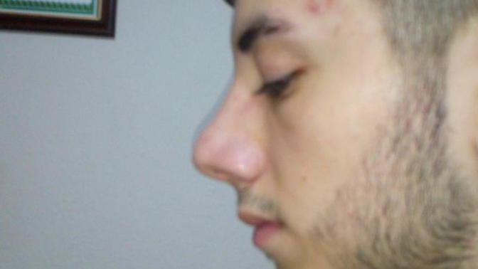 Gençler Benim ten rengim ne oluyor?