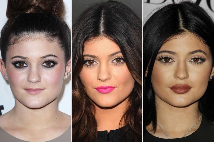 Kylie Jenner'ın dudakları sizce güzel mi ?