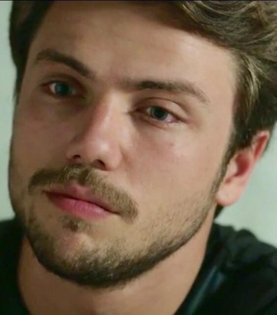 Güneşin kızlarında oynayan Tolga Sarıtaş'ın göz bebekleri neden hep anormal büyük? 👀 resimli?