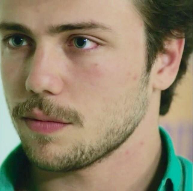 Güneşin kızlarında oynayan Tolga Sarıtaş'ın göz bebekleri neden hep anormal büyük? 👀 resimli?