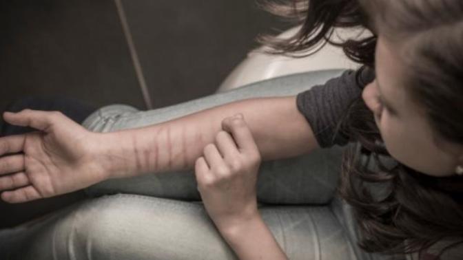 Depresyona girip kendi vucuduna Zarar verenler hakkinda ne dusunuyorsunuz?