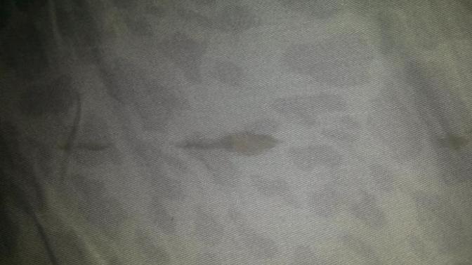 Sperm Lekesi Nasıl Geçer?