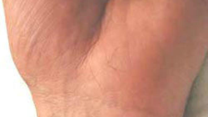 Kalın ve damarlı nasıl?