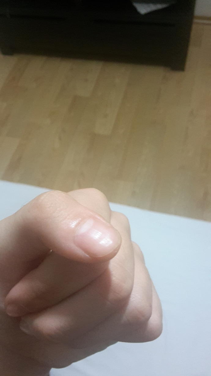 Tırnaklarım çöküyor, anlayanlar baksın lütfen?