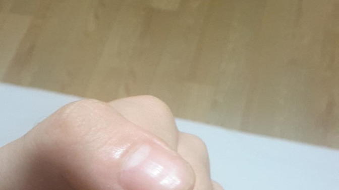 Tırnaklarım çöküyor, anlayanlar baksın lütfen?