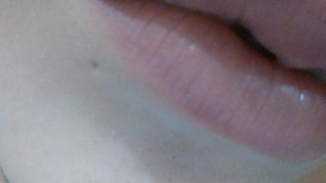 Kızlar dudagimda uzun suredir ben gibi duran siyah nokta var napicam?