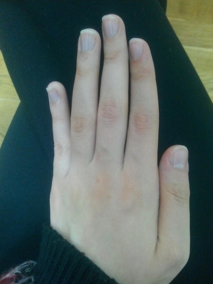 Kızlar, Tırnaklarimi begenmiyorum ne yapabilirim?