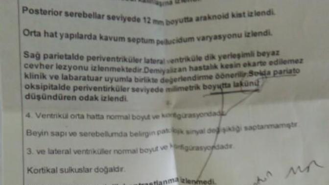 Beyin mr sonucu inceleyebilen var mı ki acaba?