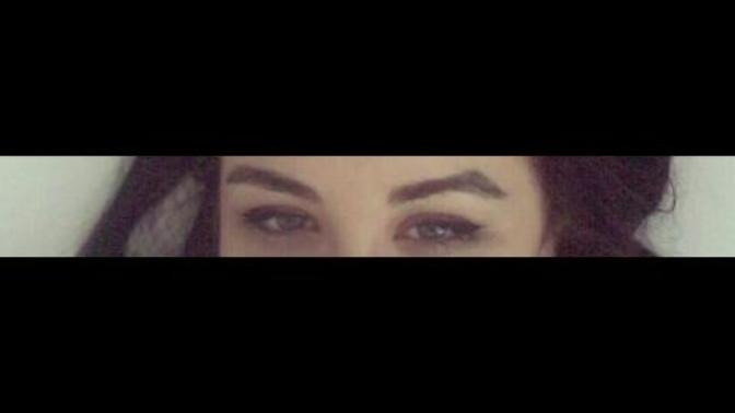 Gözüm neden böyle? (fotoğraflı) ?