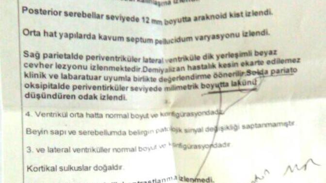 Beyin mr sonucu inceleyebilen var mııı?