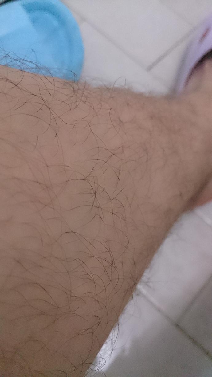 Bacak kıllarım? Resimli?