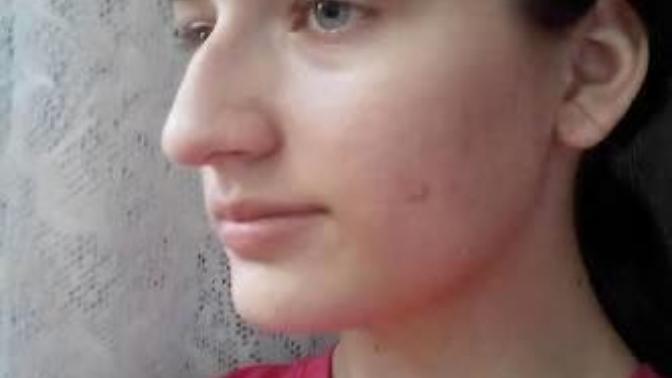 Burnum büyük? (resimli)?
