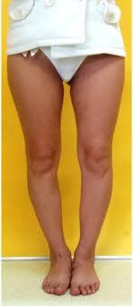 Parantez Bacak Kizlarsoruyor