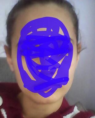 Yuzumun sekli ne?