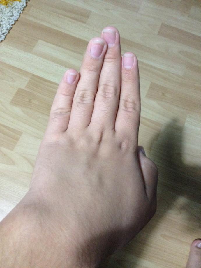 Parmaklarım mı yamuk? Niye?
