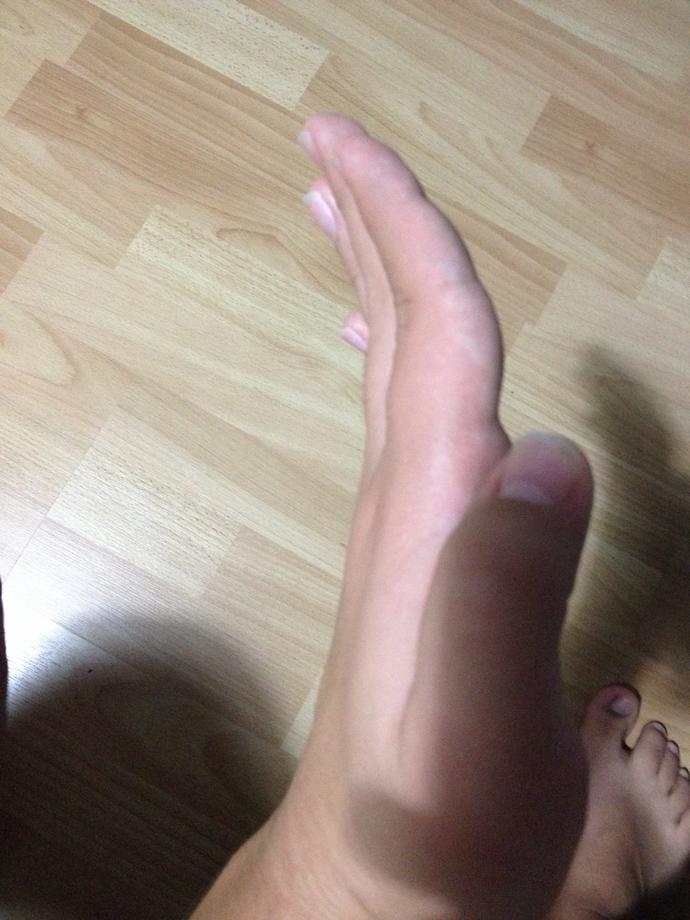 Parmaklarım mı yamuk? Niye?