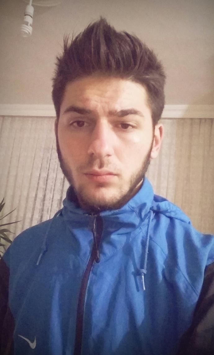 Acaba bir rahatsızlık olabilir mi (Resimli)?