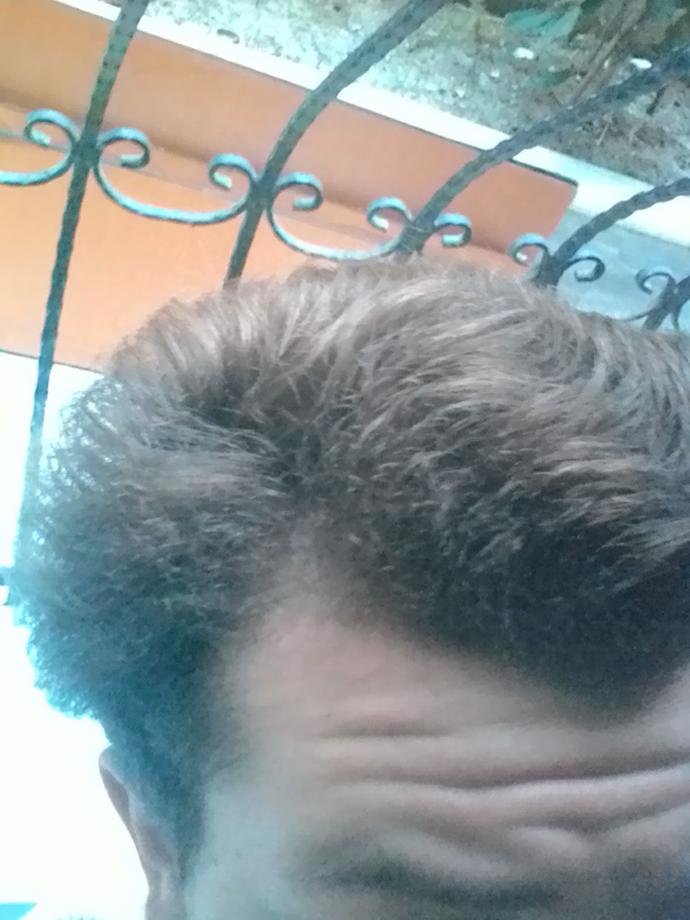 Saçlarımın bu halinden nasıl kurtulabilirim ? Keratin yüklemesi işe yarar mı ?