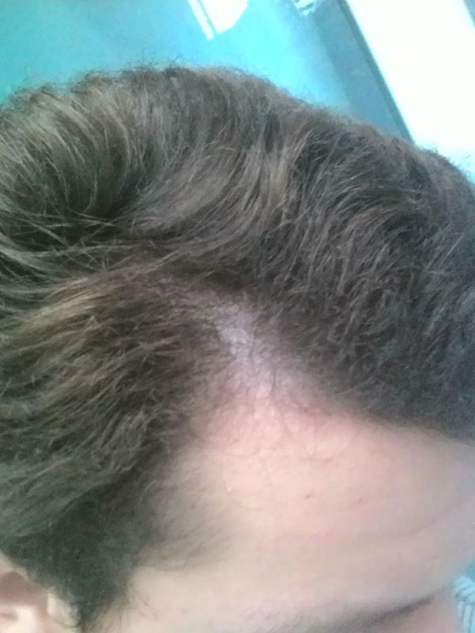 Saçlarımın bu halinden nasıl kurtulabilirim? Keratin yüklemesi işe yarar mı?