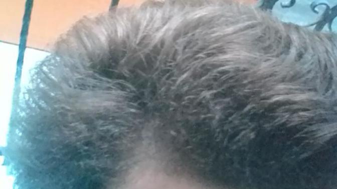 Saçlarımın bu halinden nasıl kurtulabilirim? Keratin yüklemesi işe yarar mı?