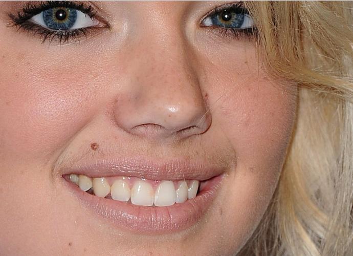 Kadınların neden bıyıkları çıkar :D ?