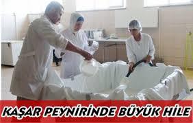 Erkeğin kaşarı ne demek?