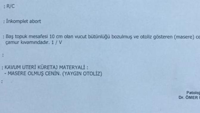 Patoloji uzmanı veya bir doktor var mı?