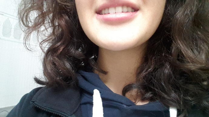 Sizce dişlerim guzel mi?