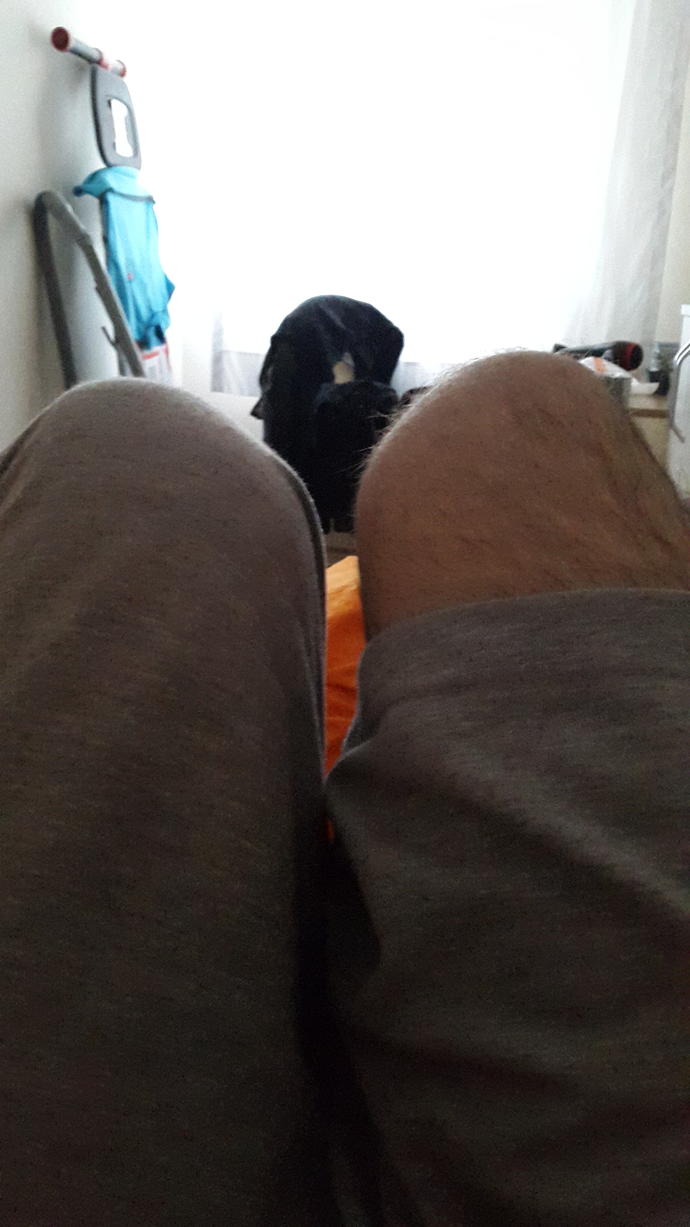 Diz kapağım dışa dönük mu ?