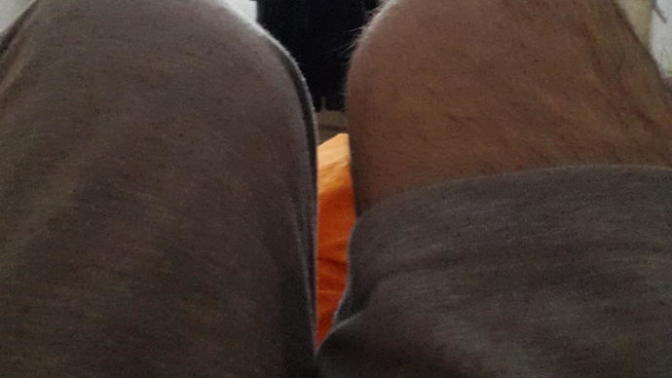Diz kapağım dışa dönük mu?