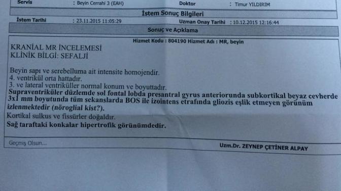 Beyin MR'ından anlayan var mı?