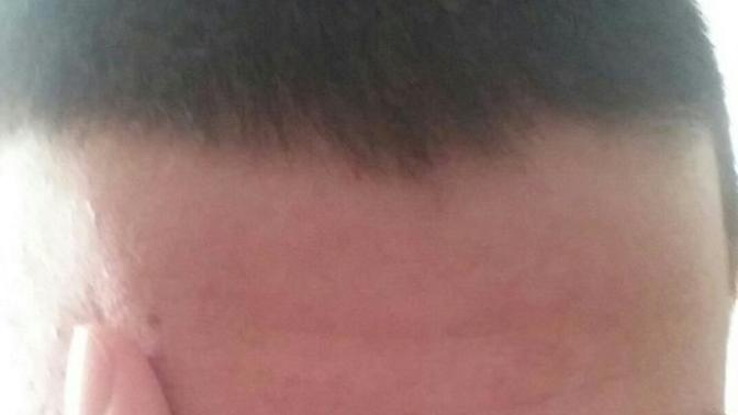 Saçlarım dökülüyor resimli?