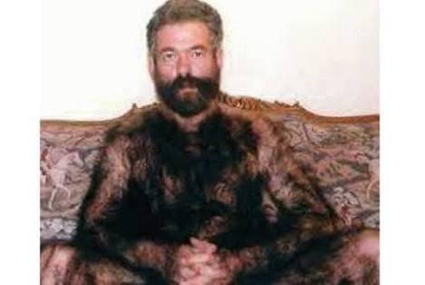 Killi insanlar neden toplumdan dişlaniyor?