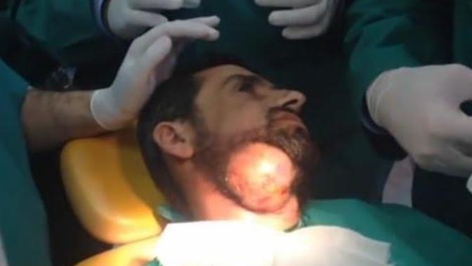 Kızlar, Çıban sıkma Sivilce Patlatma?