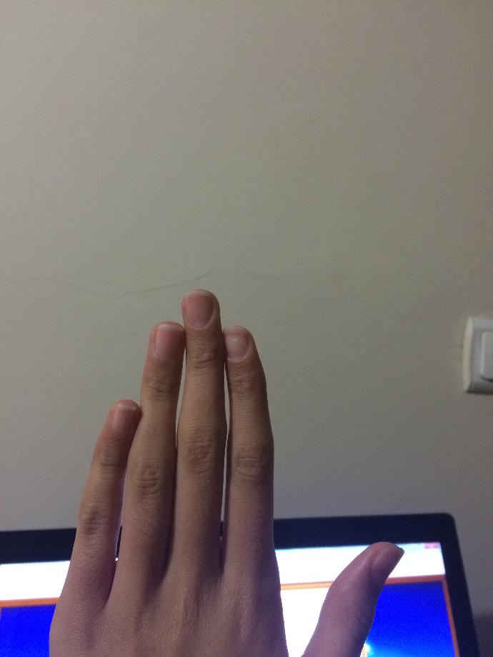 Tırnaklarımın pembe kısmı çok küçük. Oje yakışmıyor. Nasıl uzatırım? (-----RESİMLİ----)?