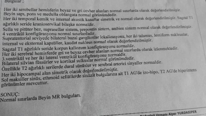 Beyin Mr dan anlayan  var mı doktor izinliymis bisey varmi?