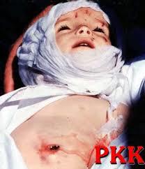 ne bereketli topraklarımız var  her türlü serefsiz yetişiyor :)))  sözde akademisyenler bebekler öldürürken nerdeydınız?