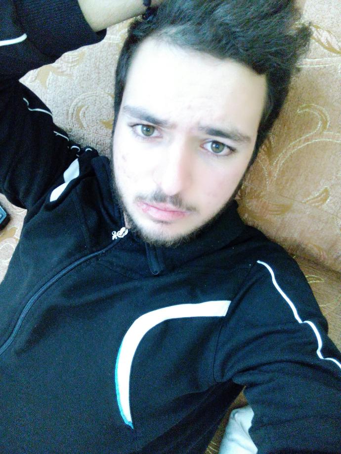 Dudaklarım çok kötü ne yapmalıyım :/ (Resimli) ?