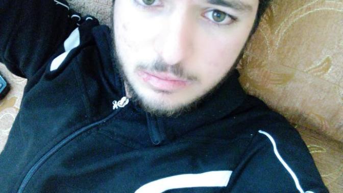 Dudaklarım çok kötü ne yapmalıyım :/ (Resimli) ?