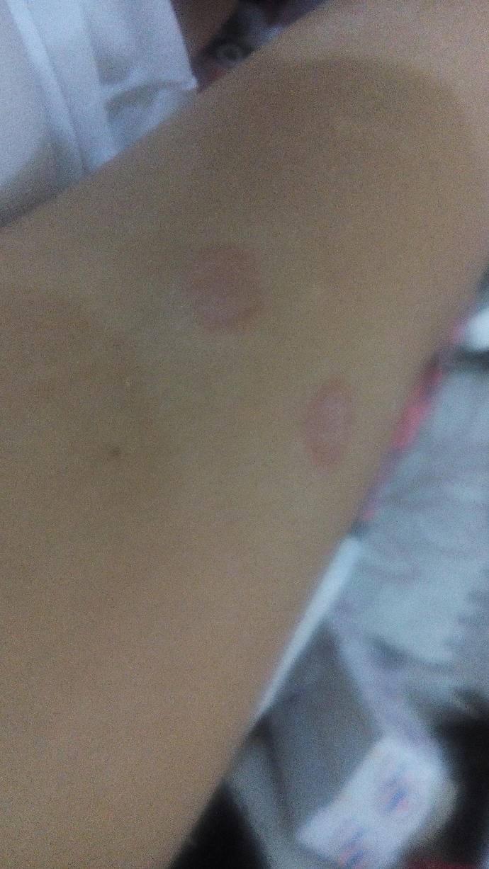 Resimdeki gül hastalığı mı? Böyle bir hastalık geöiren varmı?