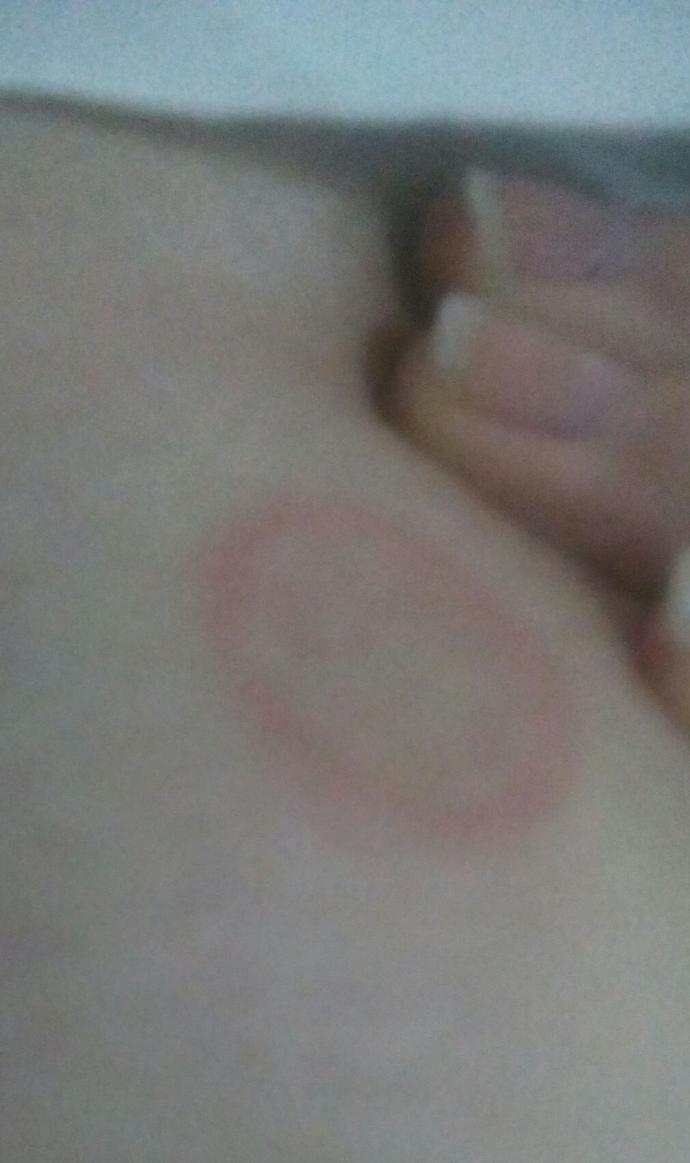 Resimdeki gül hastalığı mı ? Böyle bir hastalık geöiren var mı ?