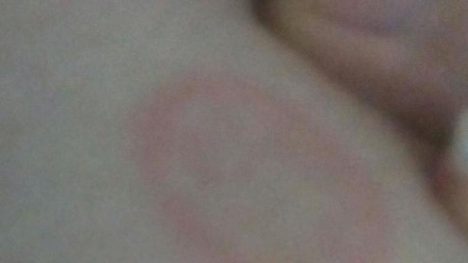 Resimdeki gül hastalığı mı? Böyle bir hastalık geöiren varmı?