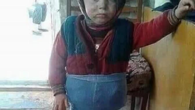 Sizinde dikkat etmenize rağmen hayat bir yerden patlak veriyormu?