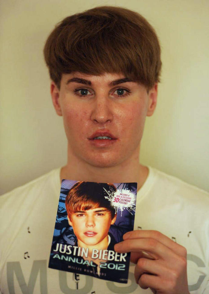 Justin Bieber'a benzemek için estetik yaptırdı?