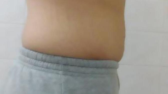 Kilolumu görünüyorum skinny fat?