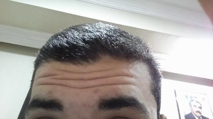 Alnımda ki çizgiler (Yardımcı olabilirmisiniz ) ?